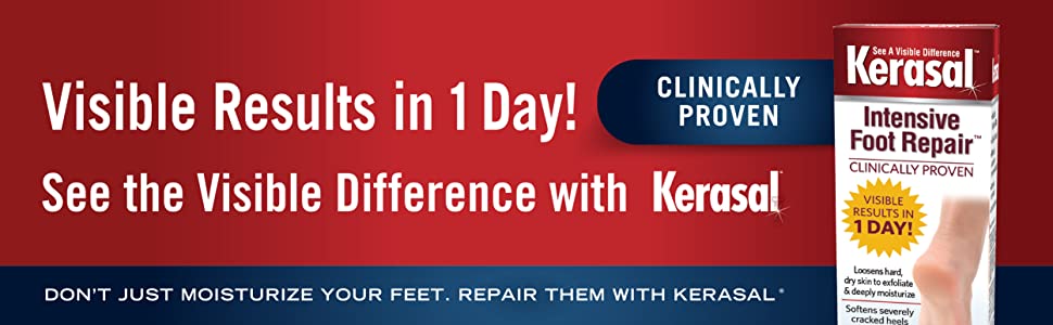 Kerasal. dry feet. cracked feet, dry cracked feet Kerasal, Kerasal repair, clinically proven